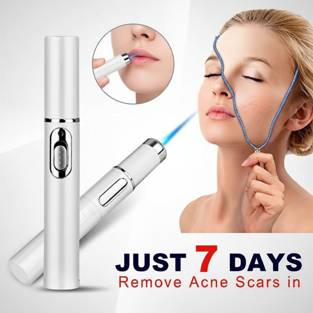 Blue Light Therapy Acne Treatment Pen Anti-Acne, Scar & Wrinkle Removal Skin Care Device