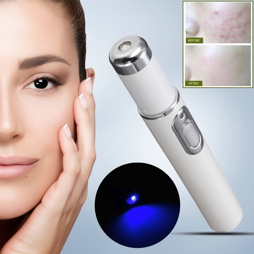 Blue Light Therapy Acne Treatment Pen Anti-Acne, Scar & Wrinkle Removal Skin Care Device