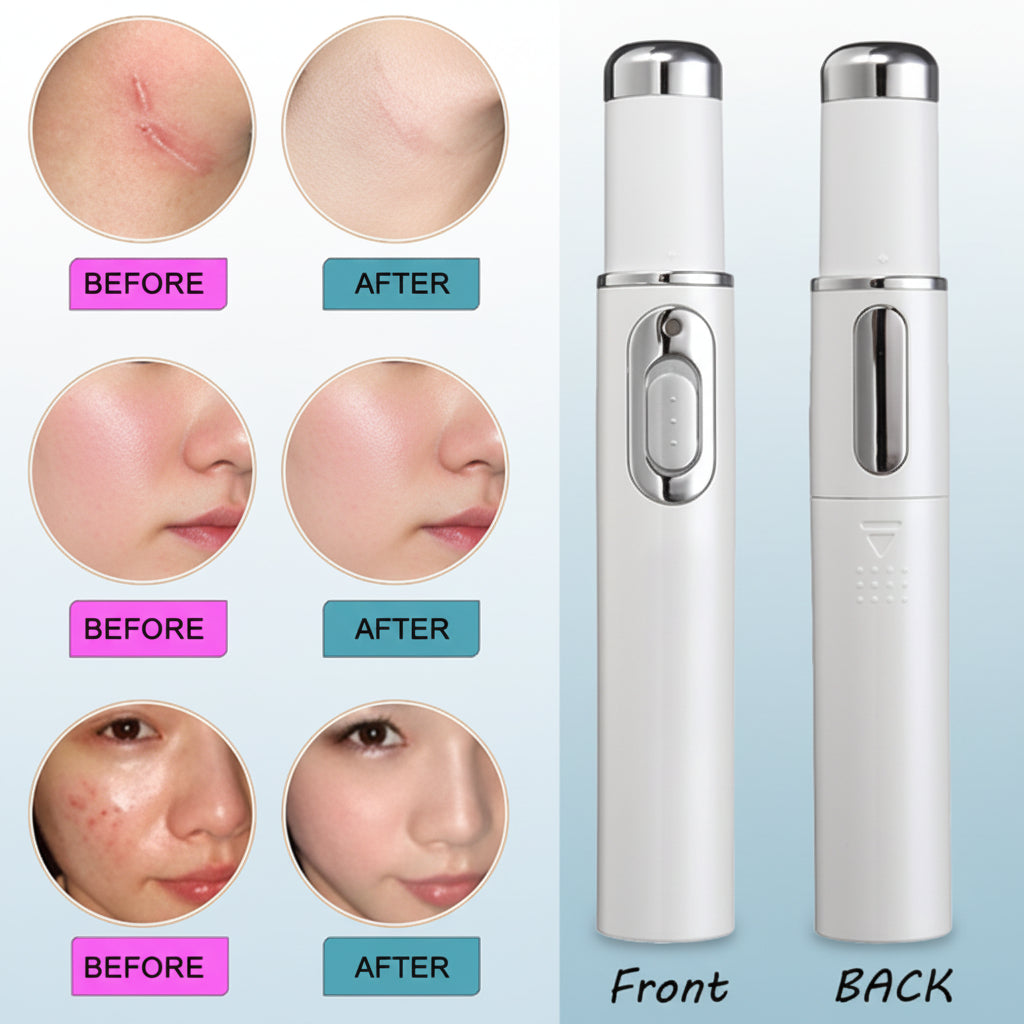 Blue Light Therapy Acne Treatment Pen Anti-Acne, Scar & Wrinkle Removal Skin Care Device